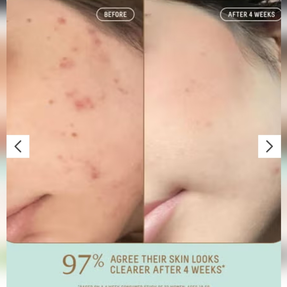 NIB $24 Biossance Squalane + Probiotic Gel Moisturizer Mini 15ml - Picture 5 of 12